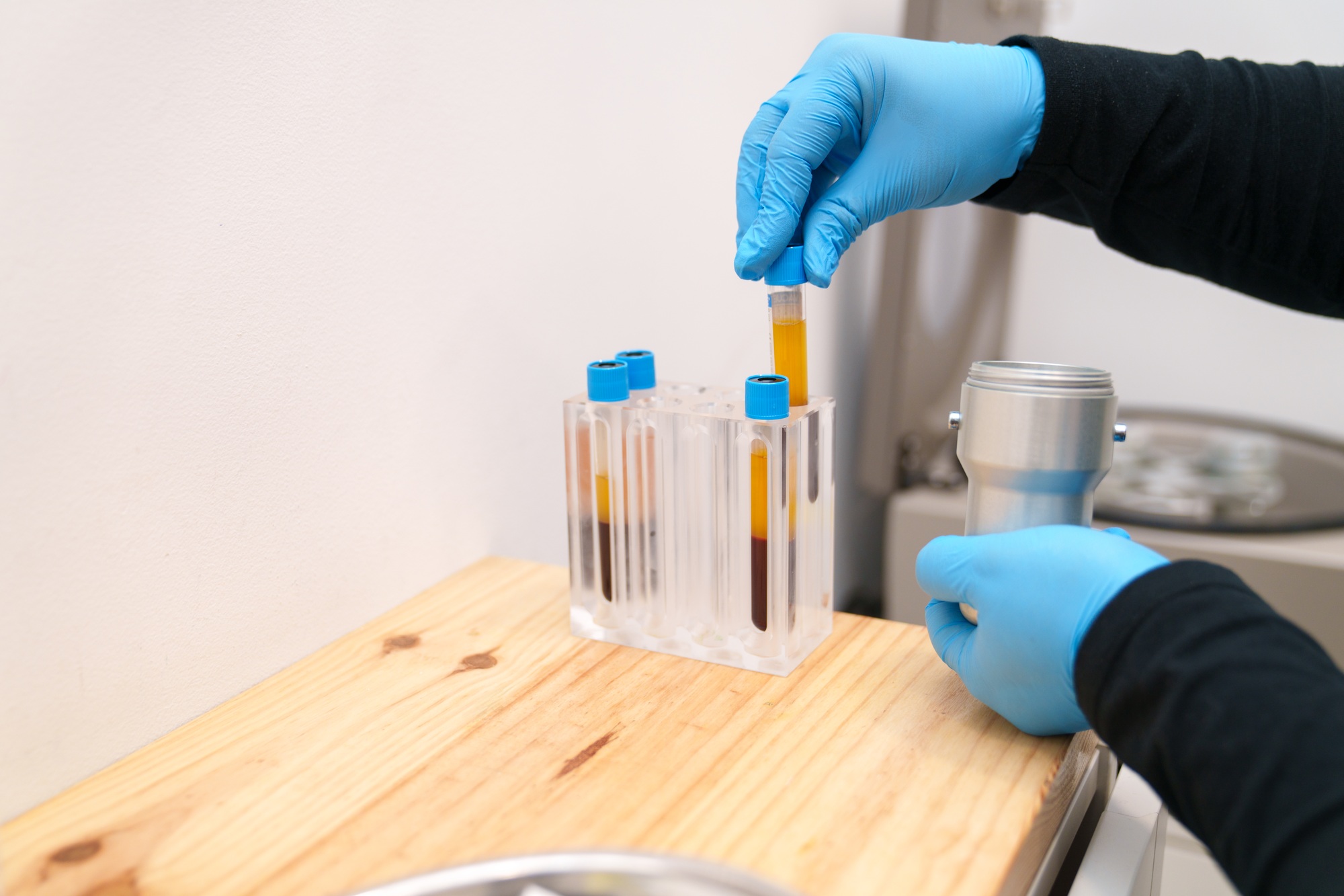 Nurse Preparing Platelet-Rich Plasma Samples in Clinic